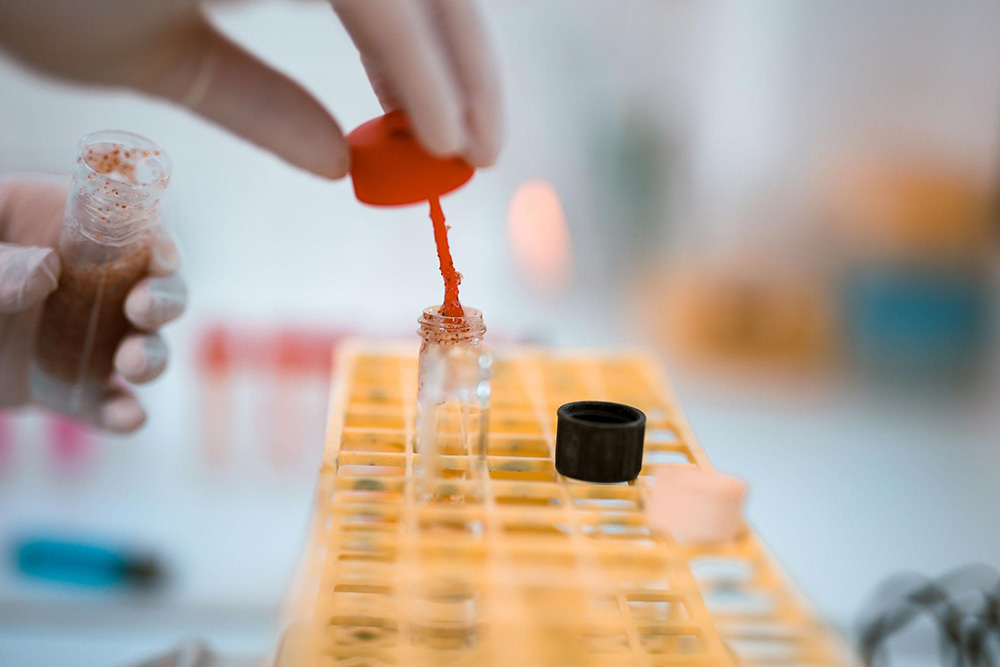 Ankara’da D Vitamini Testi Nerede Yaptırılır? Eksiklik Belirtileri ve Sonuçların Anlamı